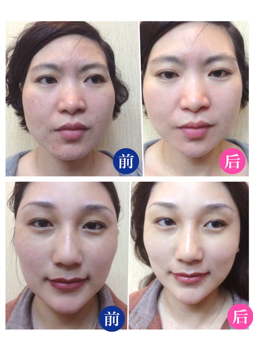 韓國皮膚管理 揭秘韓國女士好皮膚的秘訣